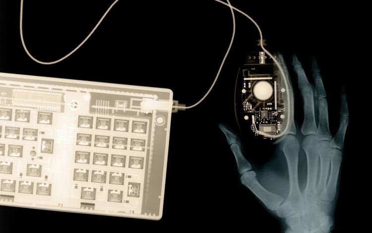 рука, клавиатура, рентген, hand, keyboard, x-ray