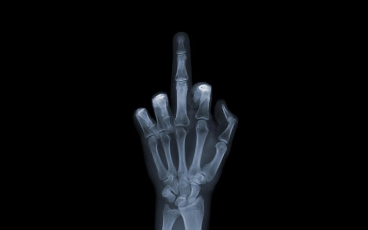обои, рука, снимок, рентген, кости, fuck you, фак ю, валлпапер, wallpaper, hand, the, x-ray, bones, fuck u