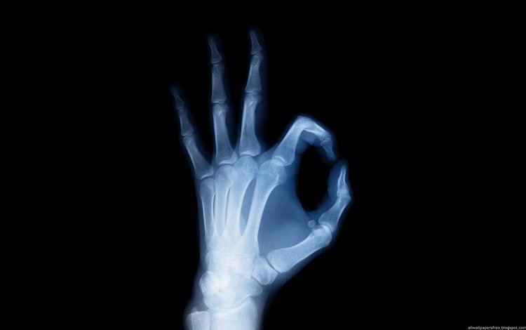 рука, черный фон, рентген, кости, скелет, ок, hand, black background, x-ray, bones, skeleton, ok